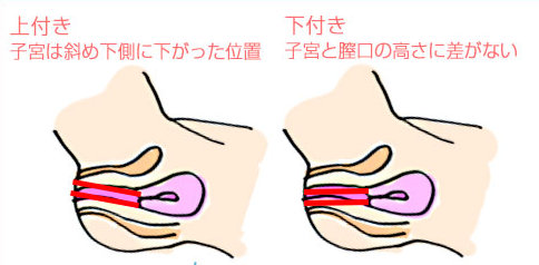 image 303上付き？下付き？膣の位置…見分け方と一番快感を得られるのはどの位置？